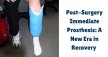 Post-Surgery Immediate Prosthesis: Post-Op Prosthesis Impact