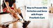 How to Prevent Skin Irritation & Sores with Prosthetic Care