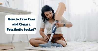 How to Take Care and Clean a Prosthetic Socket?