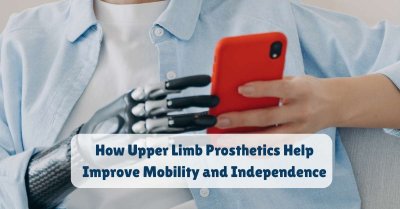 How Upper Limb Prosthetics Help Improve Mobility