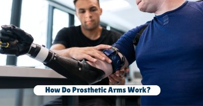 How Do Prosthetic Arms Work?