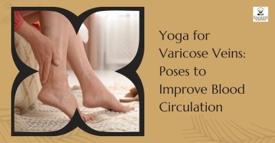 Yoga for Varicose Veins: Poses to Improve Blood Circulation