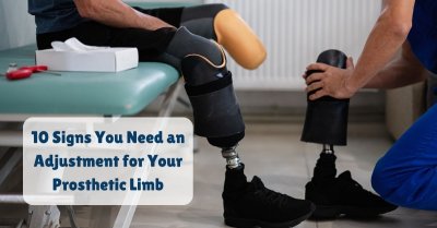 10 Signs You Need an Adjustment for Your Prosthetic Limb